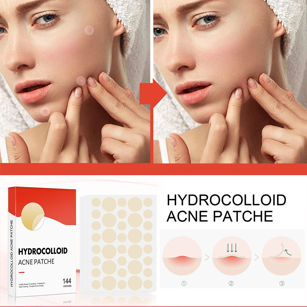 Hydrocolloid Patches